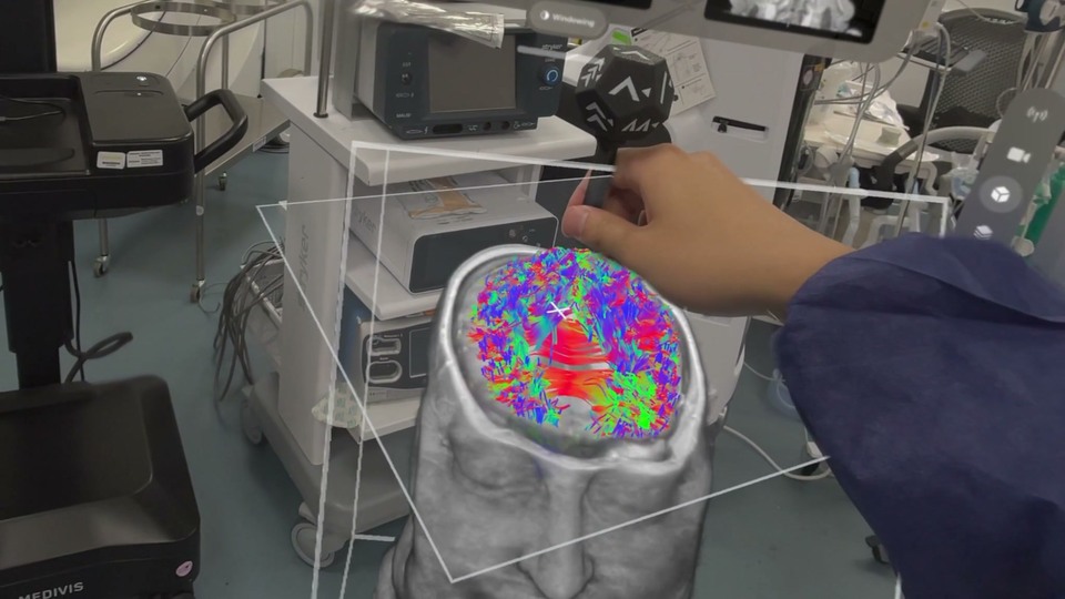 A handheld tracking tool above a floating 3D head scan with colored brain fibers in Medivis Viewer