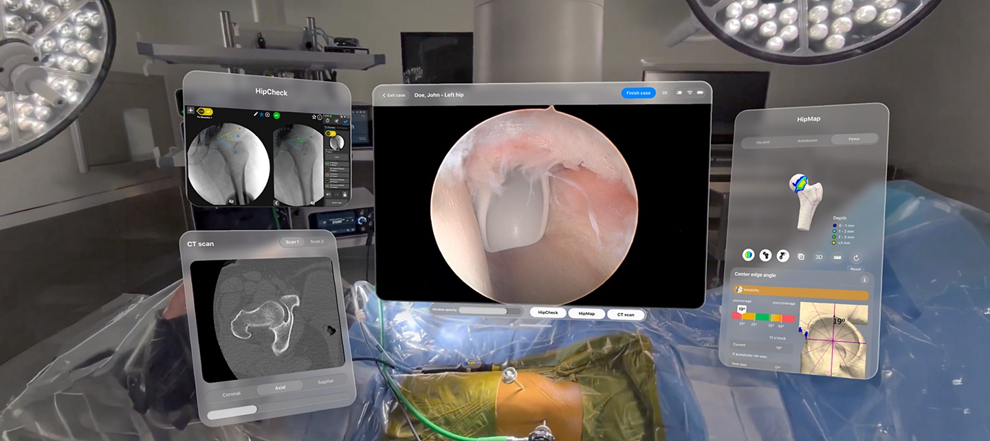 SportSuite Vision view with an arthroscopy feed, CT scan, HipCheck measurements, and HipMap plan arranged over an operating room